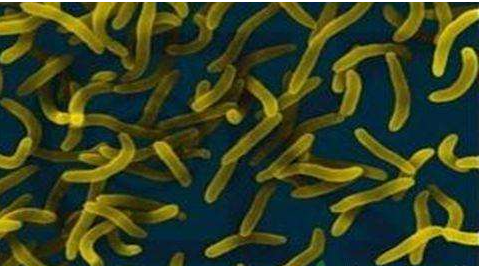 微生物菌劑好？好在哪里您知道嗎？